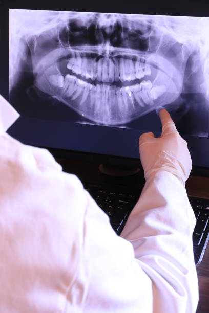 Best Emergency Tooth Extraction in Minot, ND